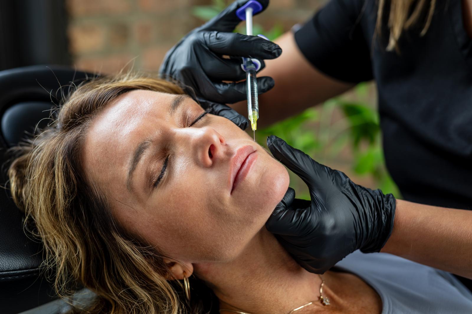Dermal Fillers